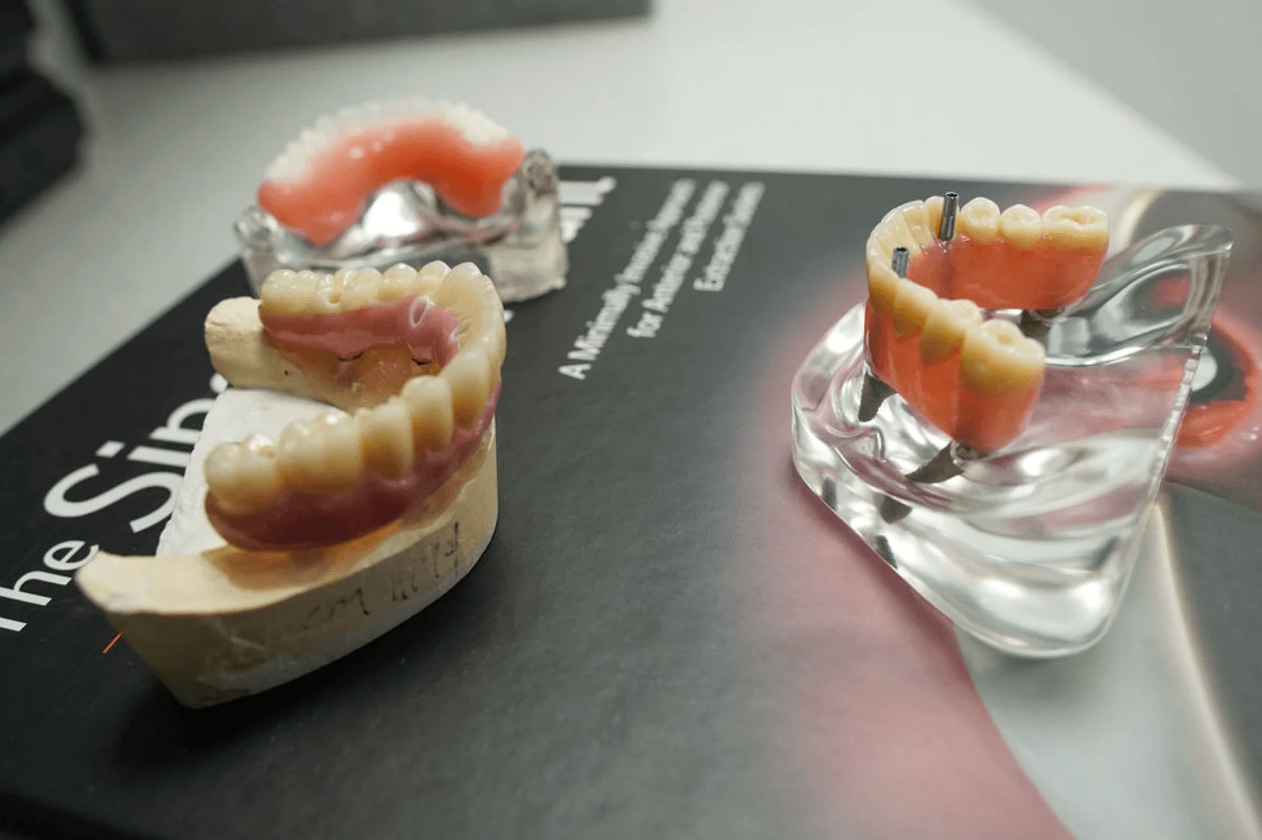 upper-dental-implants-models