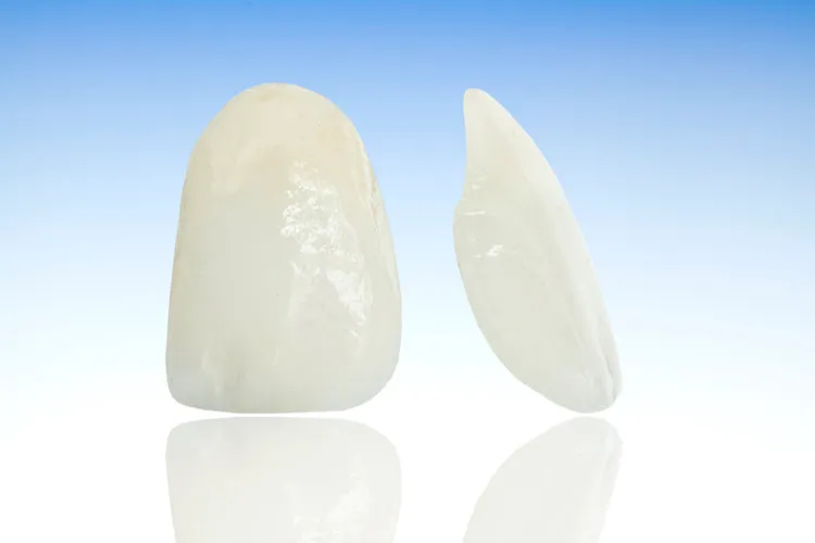 Porcelain Veneers Indianapolis