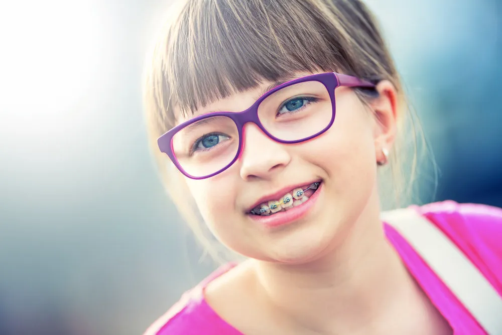 Braces for adult and children - Orthodontics in Indianapolis