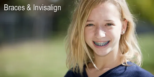 Braces and Invisalign Indianapolis - Contemporary Orthodontics for Children and Adults