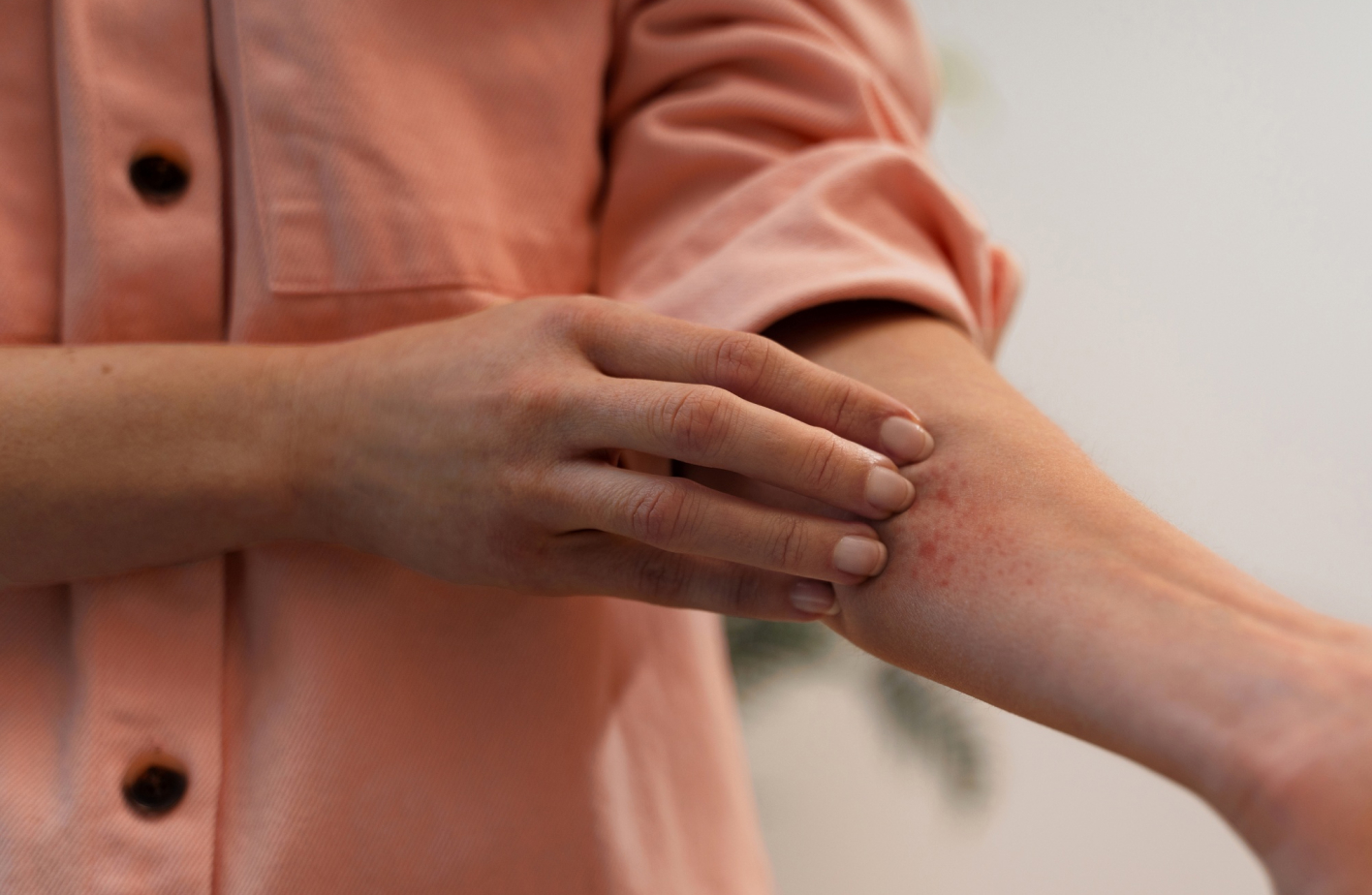¿Cómo saber si tengo Herpes Zóster? Síntomas clave y fases iniciales