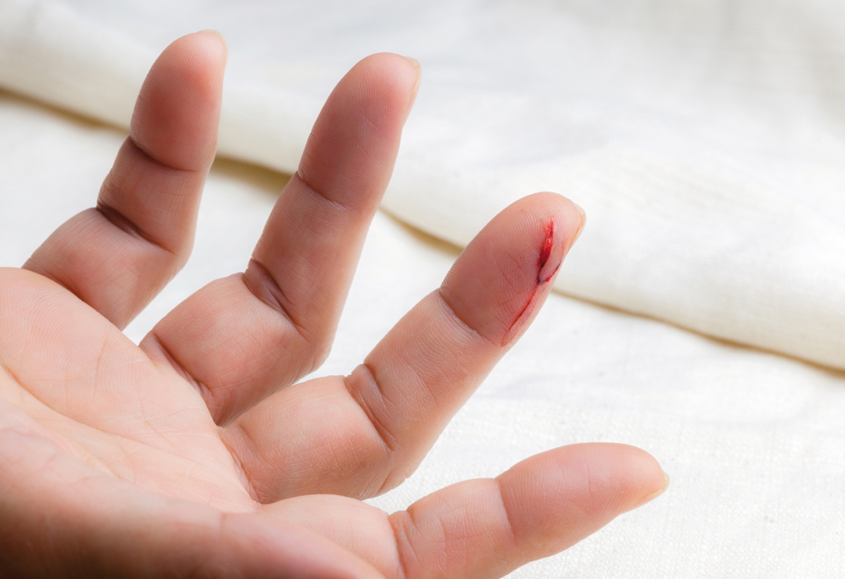 ¿Si me corto con vidrio debo vacunarme contra el tétanos?