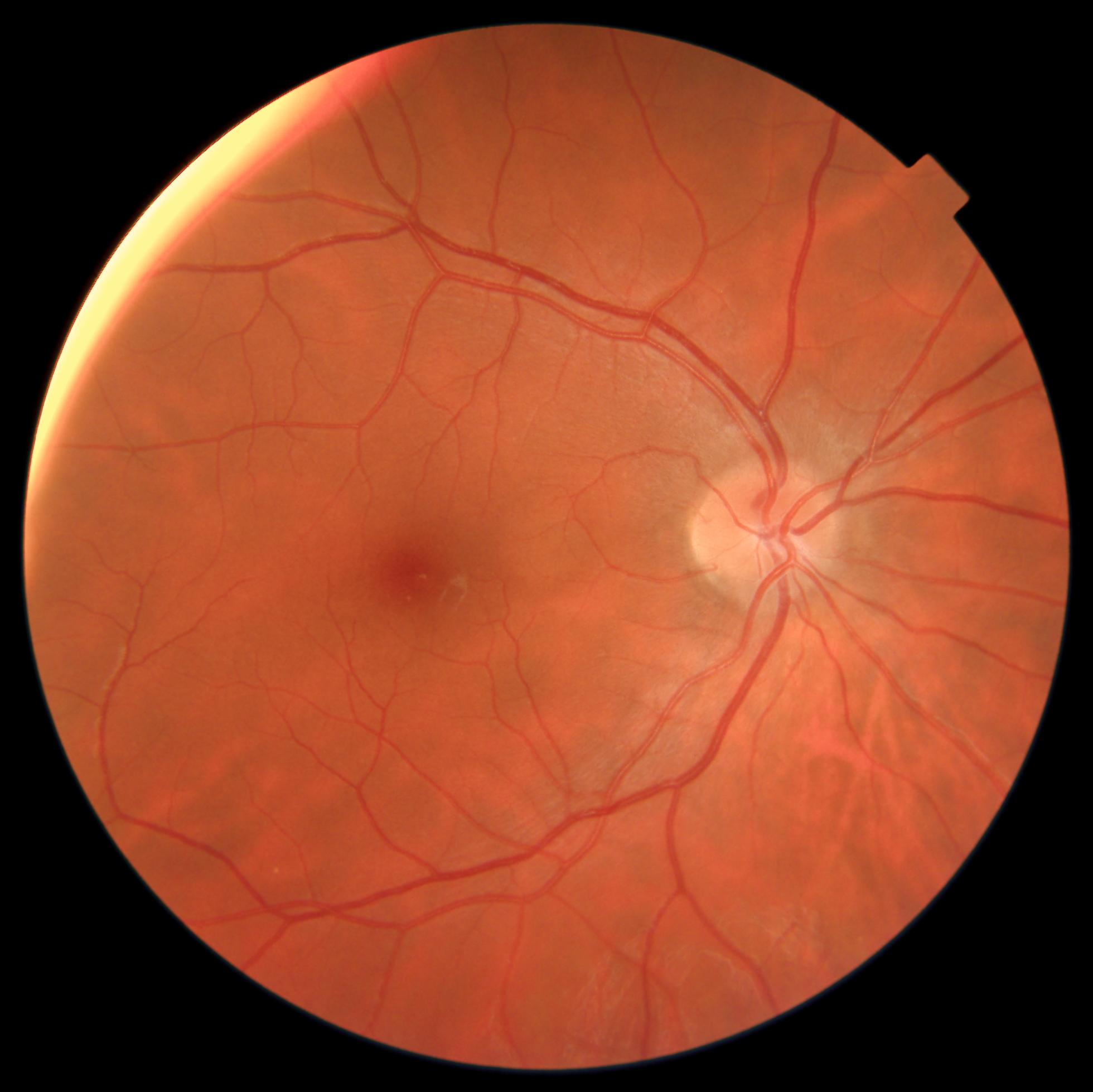 Care1 blog: Trauma-Linked Flashes