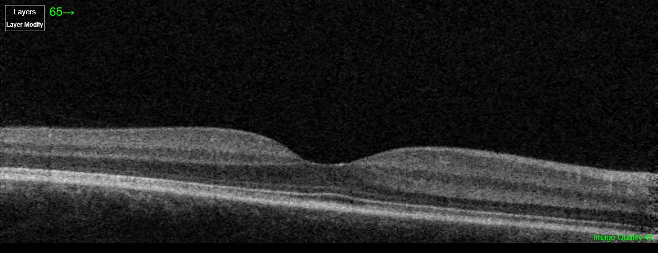 Care1 blog: Trauma-Linked Flashes