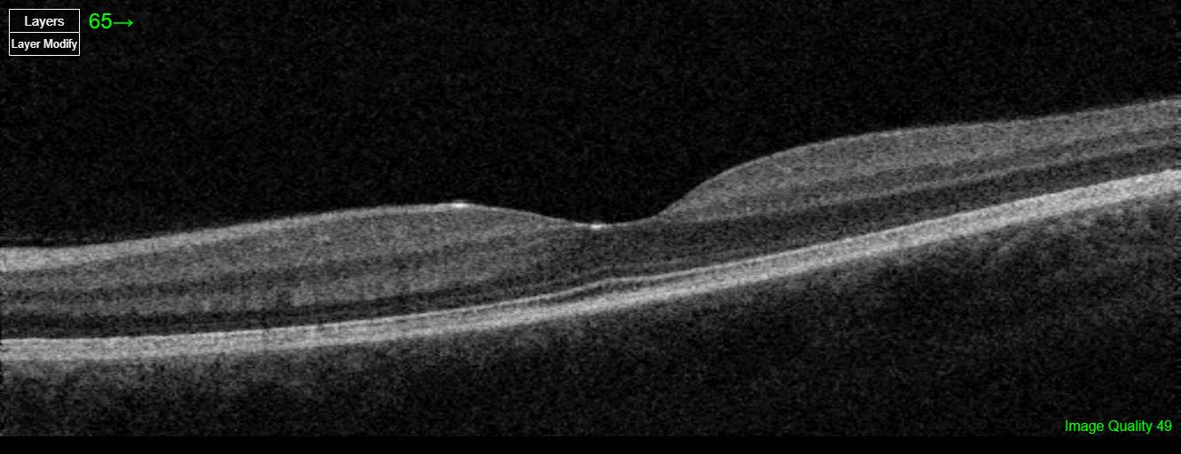 Care1 blog: Trauma-Linked Flashes