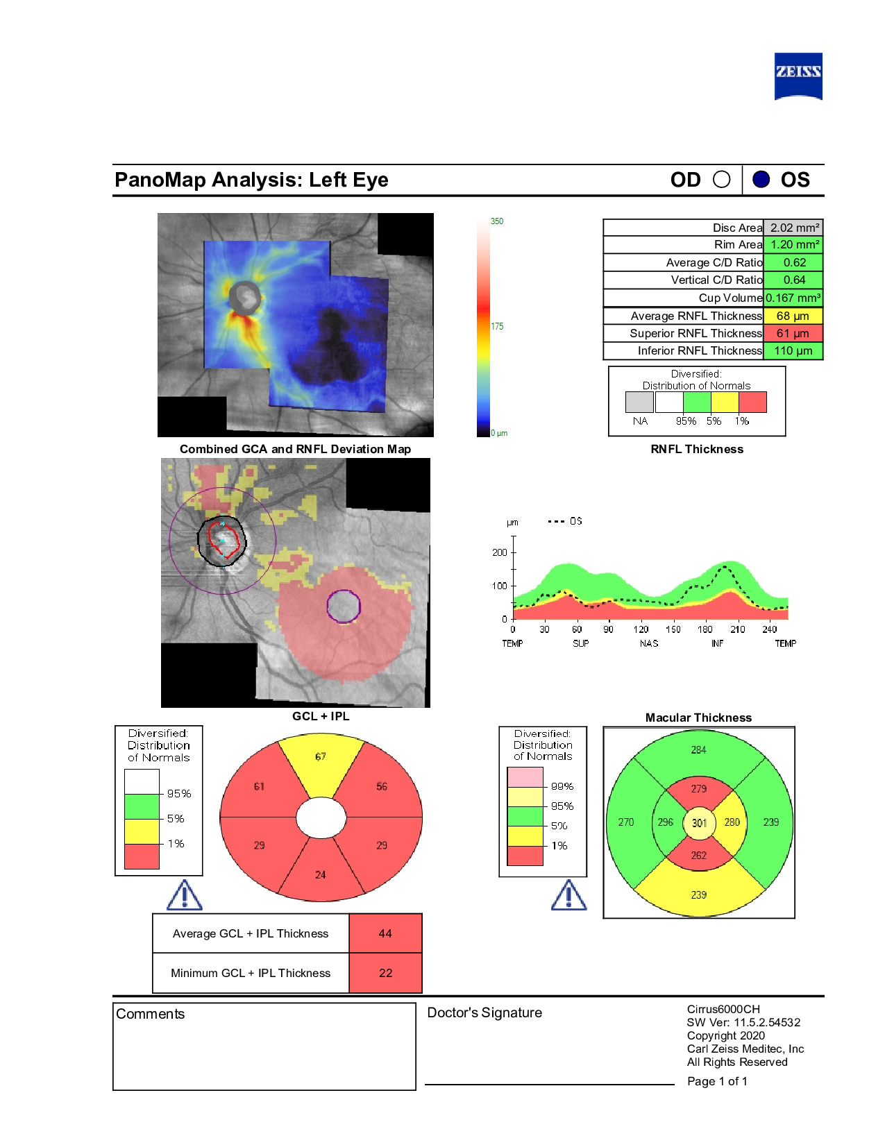 Left eye OCT RNFL report from Care1