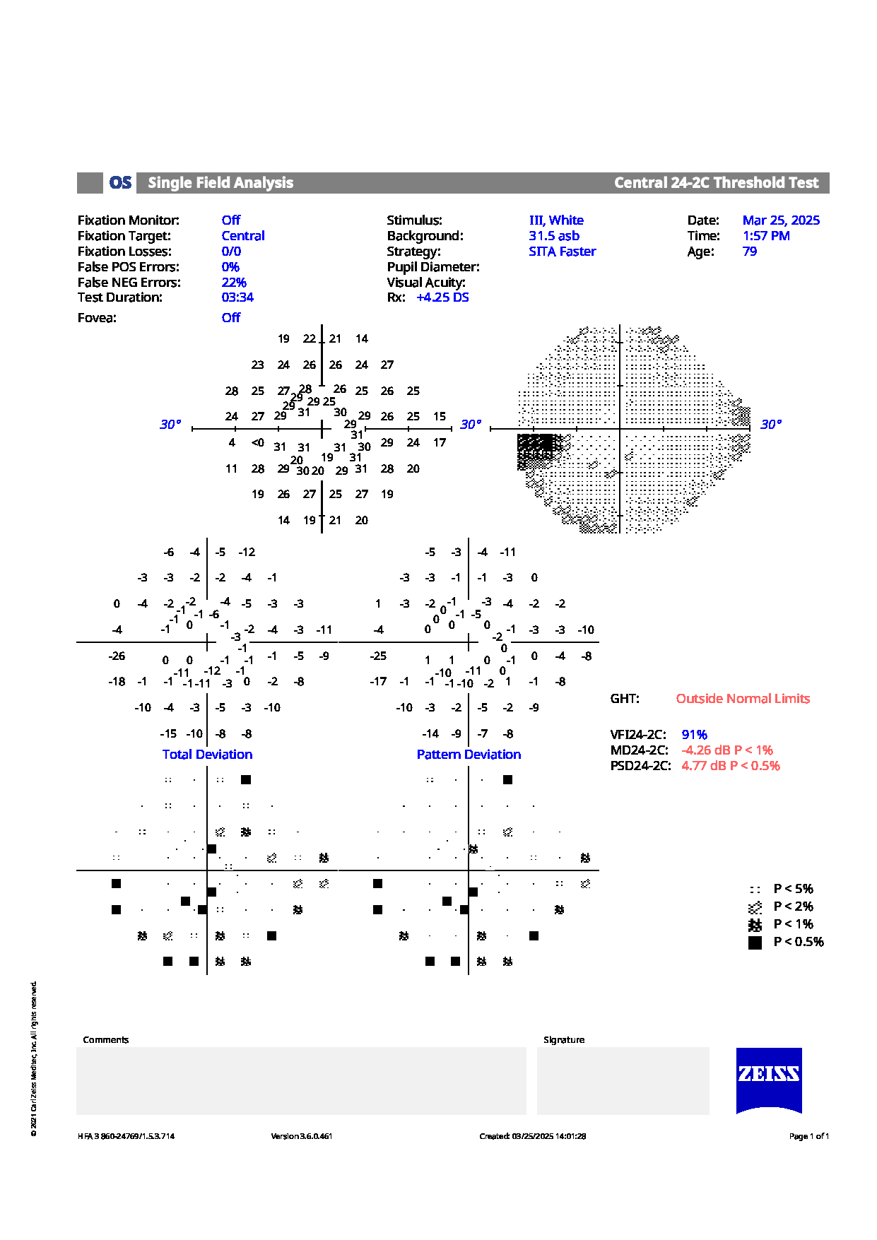 Left eye visual field test from Care1