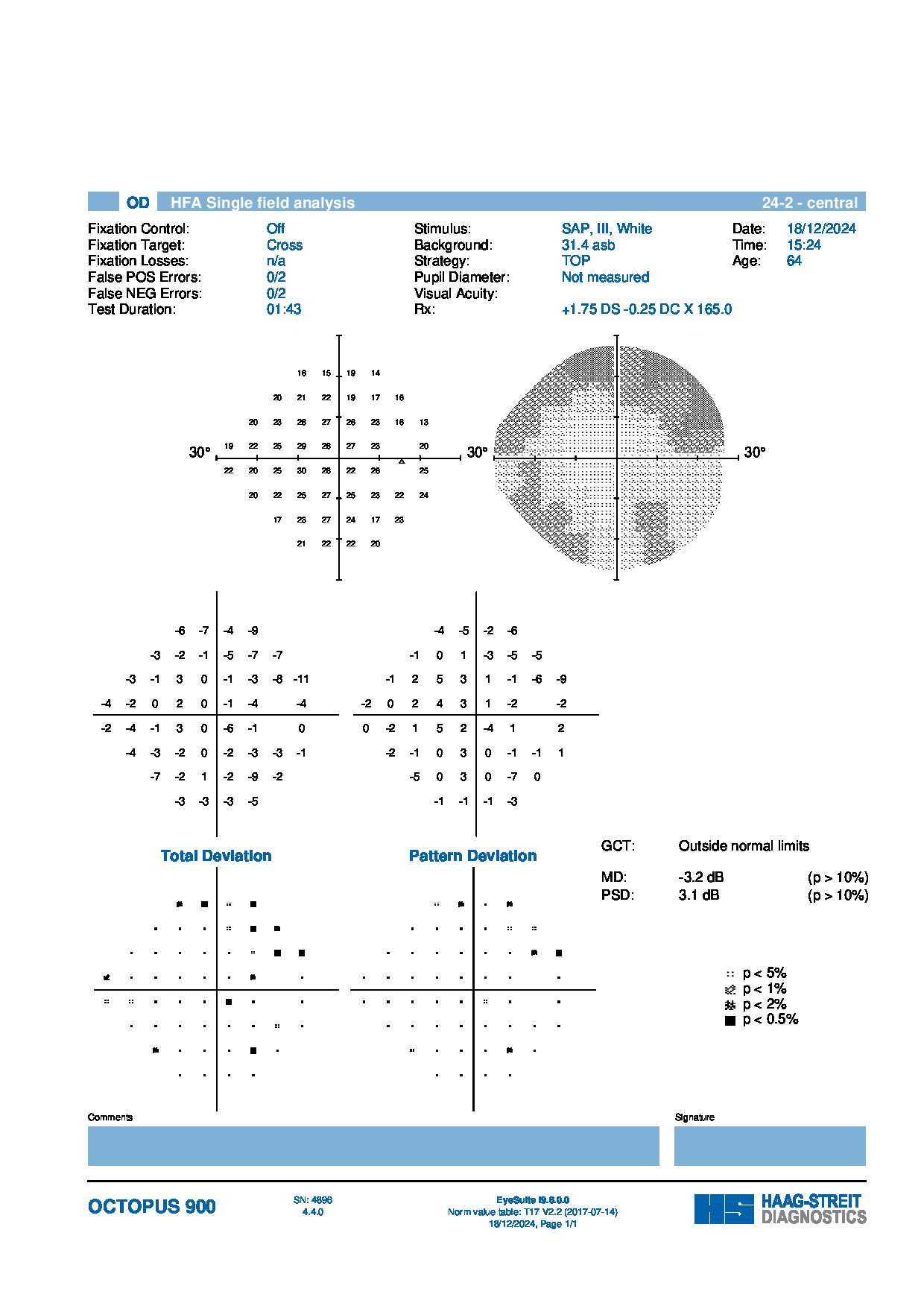 OD Visual Field from Care1 case study.