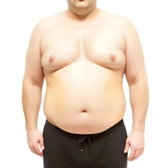 Frontalansicht eines Mannes mit Übergewicht, der ohne Hemd und in schwarzer Hose dasteht. Das Bild stellt eine größere Körperstatur dar