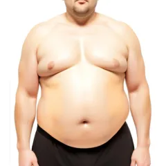 Frontalansicht eines Mannes mit Übergewicht, der ohne Hemd und in schwarzer Hose dasteht. Das Bild stellt eine größere Körperstatur dar