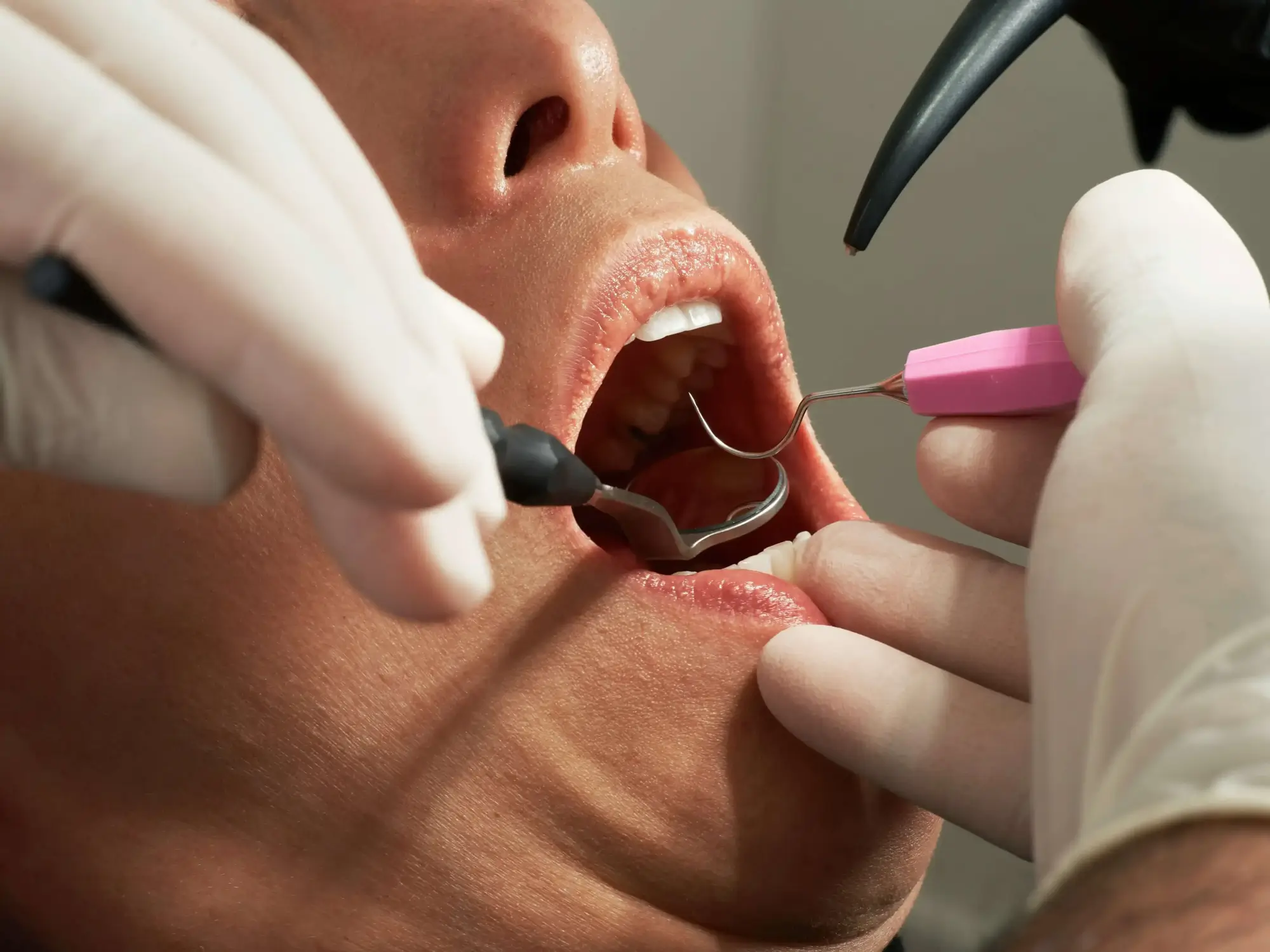 patient with an emergency dentist Georgetown KY