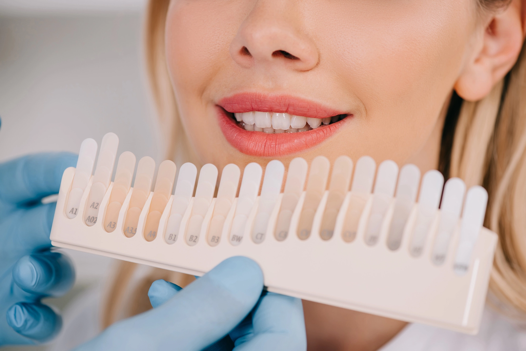 Smiling woman with blonde hair holding a tooth shade guide near her teeth. Gloved hands assist, indicating a dental whitening or matching procedure