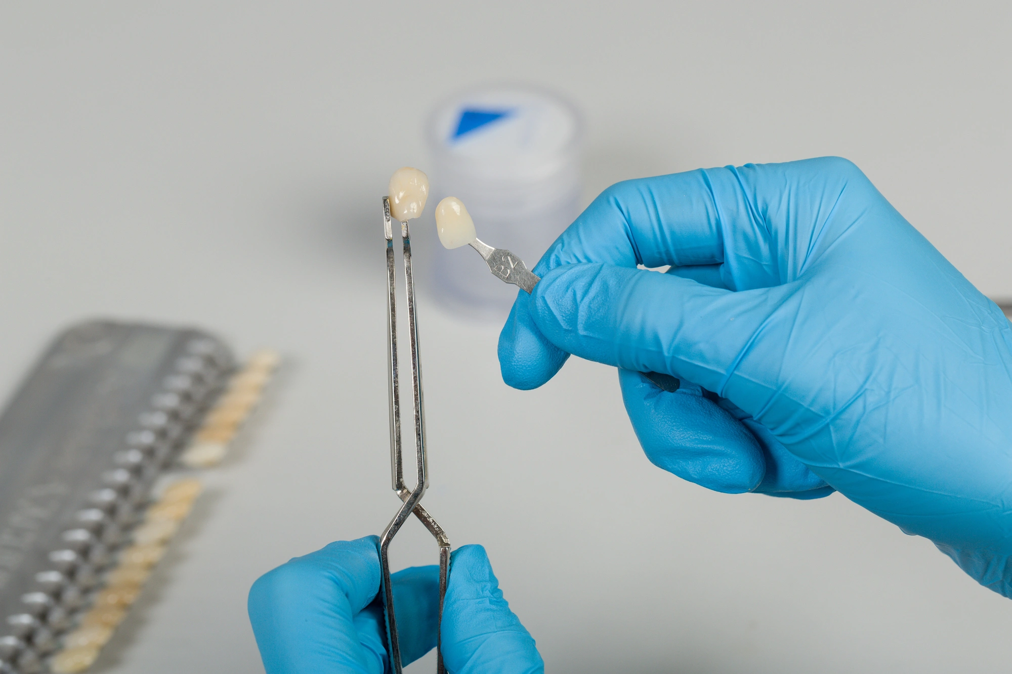 Hands in blue gloves holding dental shade guide tabs for matching tooth color, with a blurred shade chart in the background