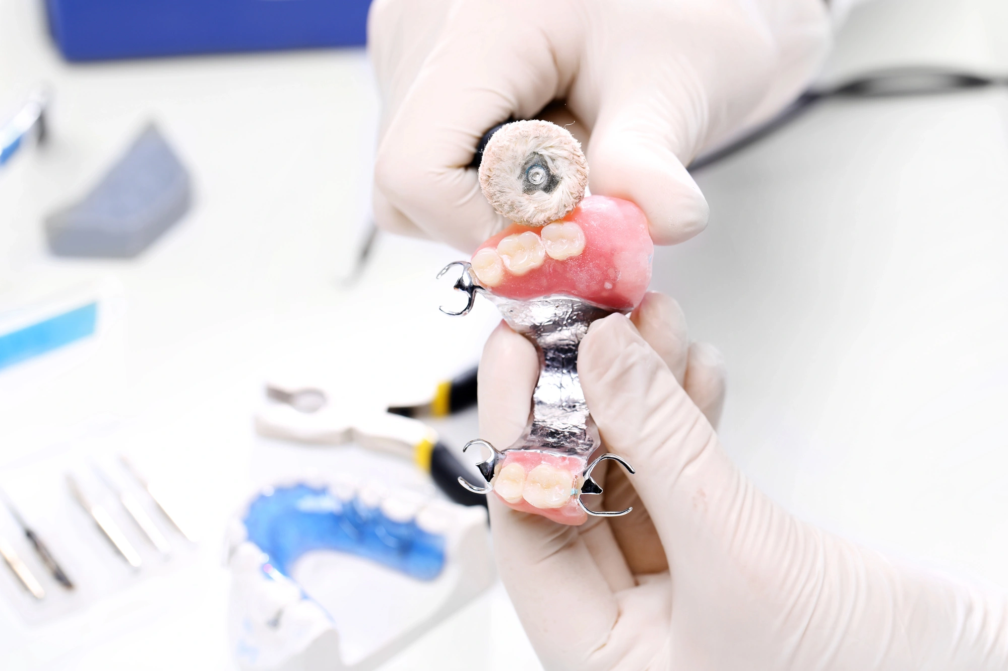 Dental technician polishing a partial denture with a rotary tool in a clinical dental lab setting