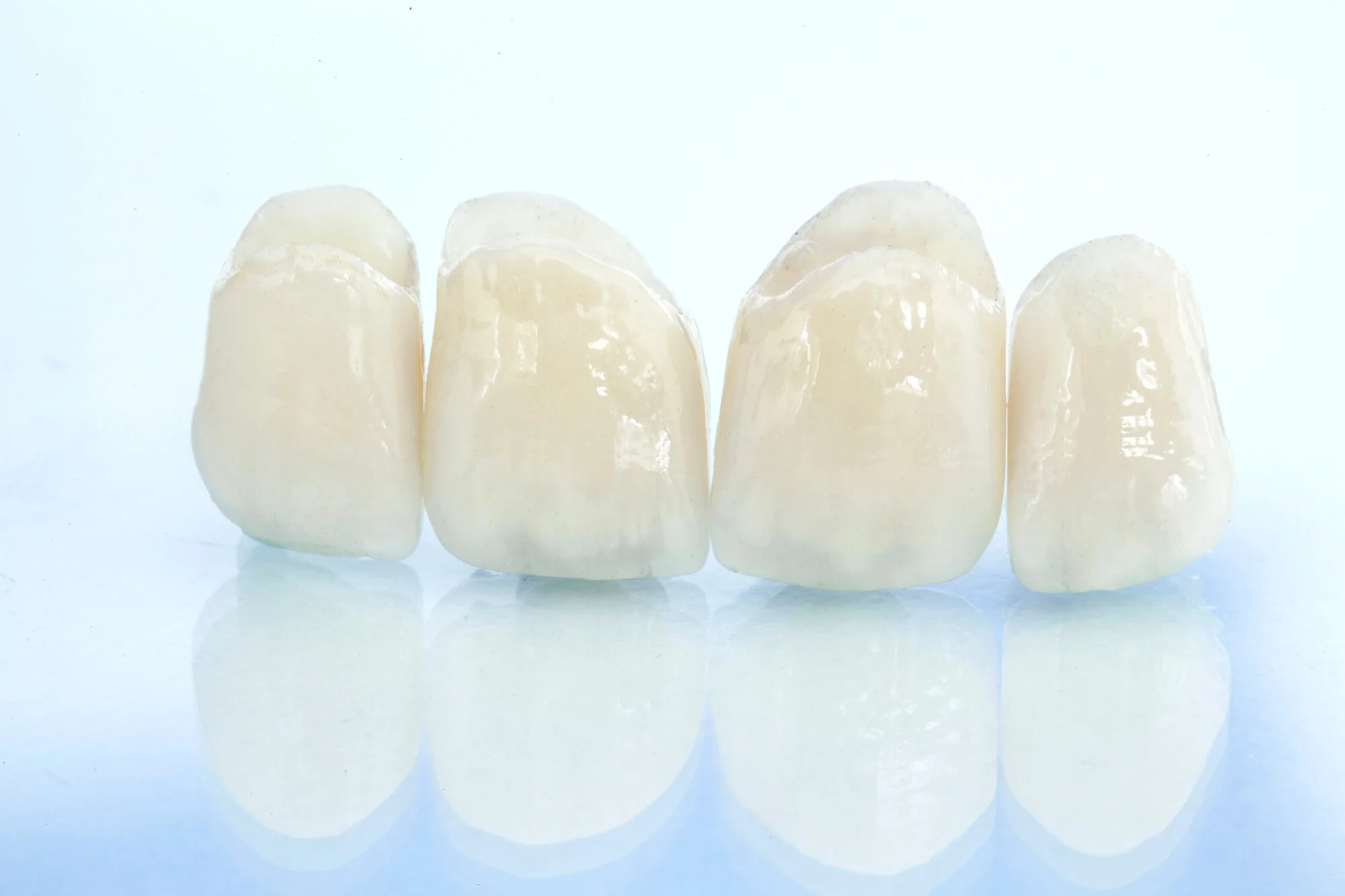 Ceramic dental crowns in Lincoln Square, with a light blue gradient background.