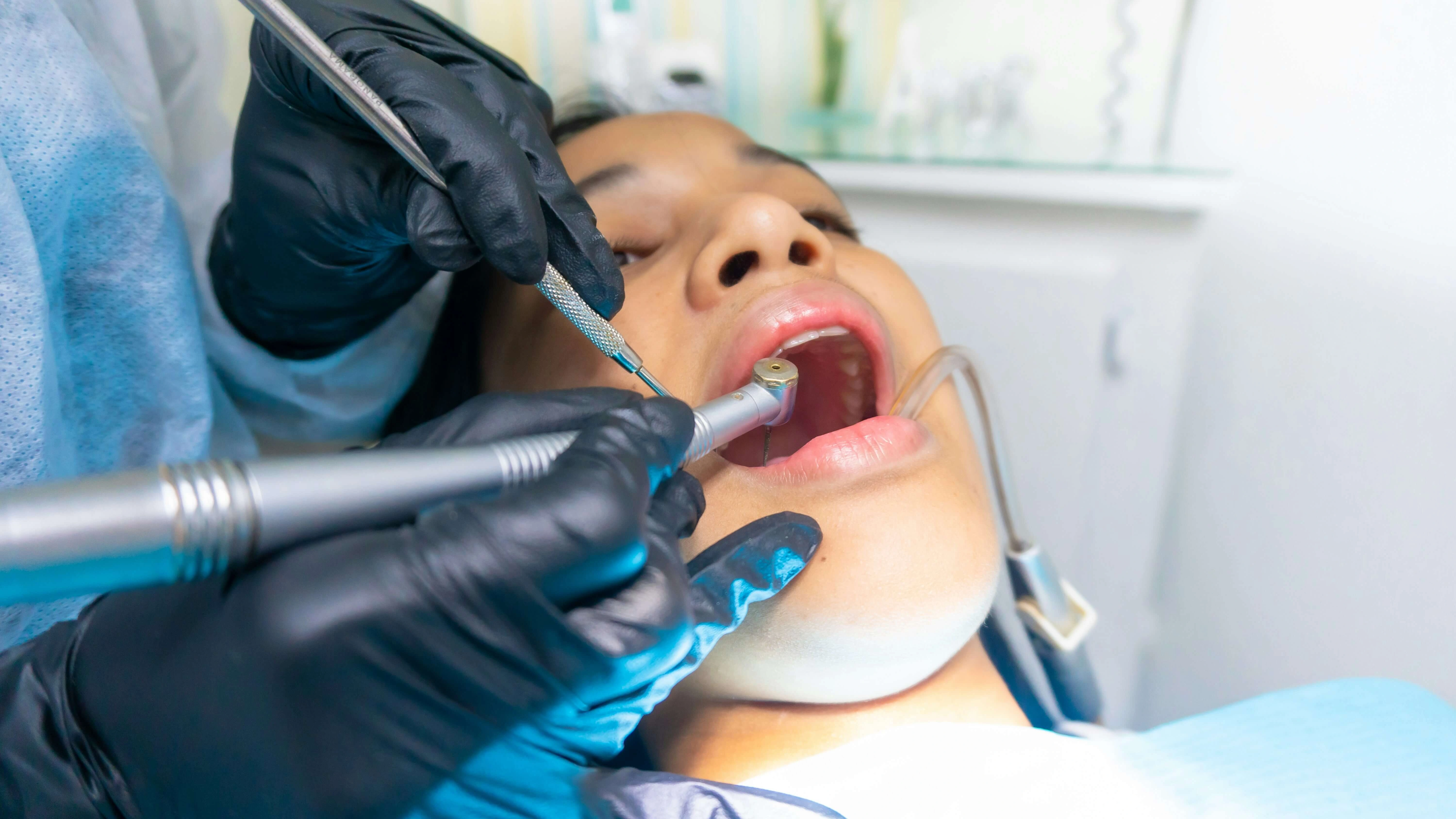 getting Same-Day Dental Crowns