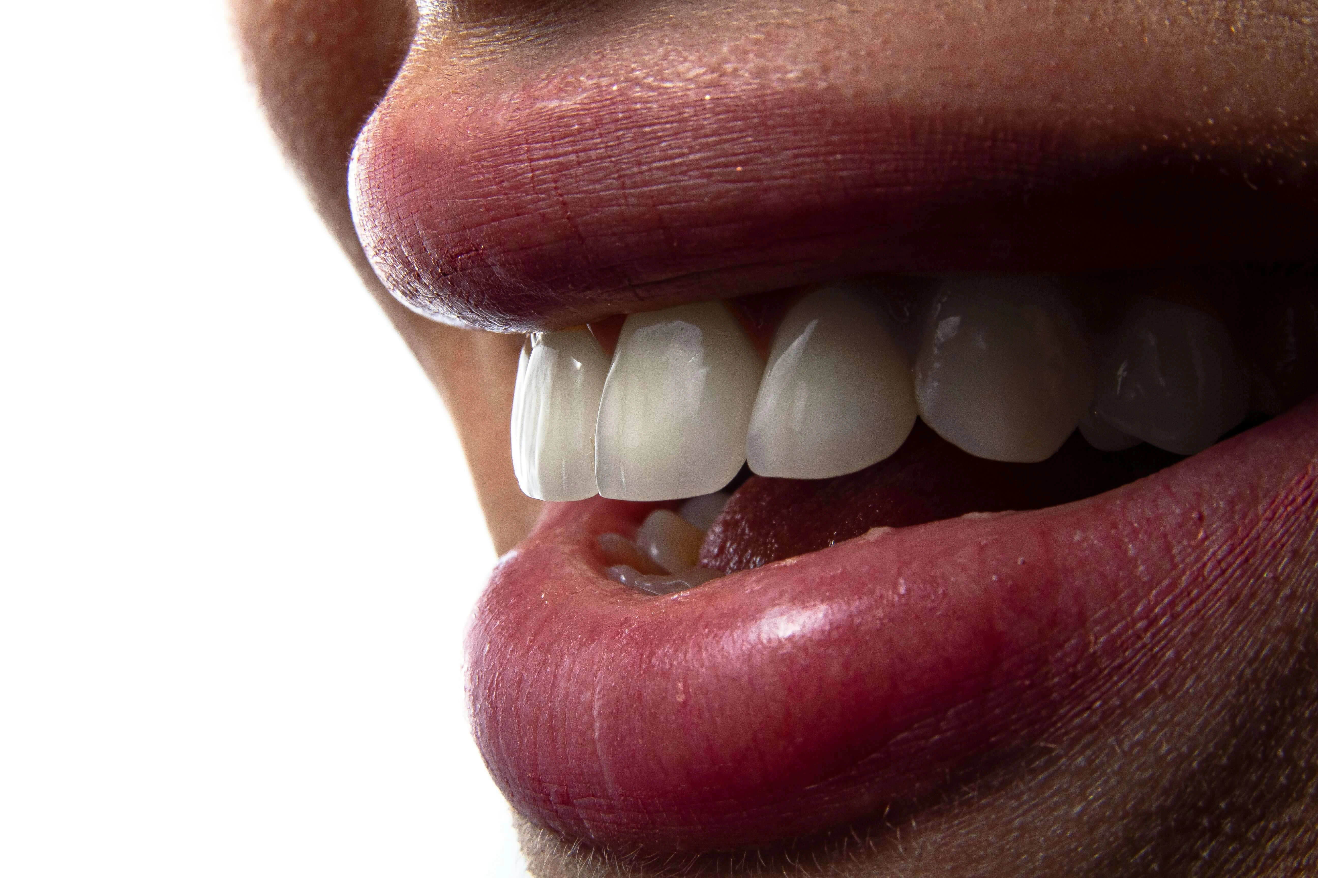 after getting Same-Day Dental Crowns