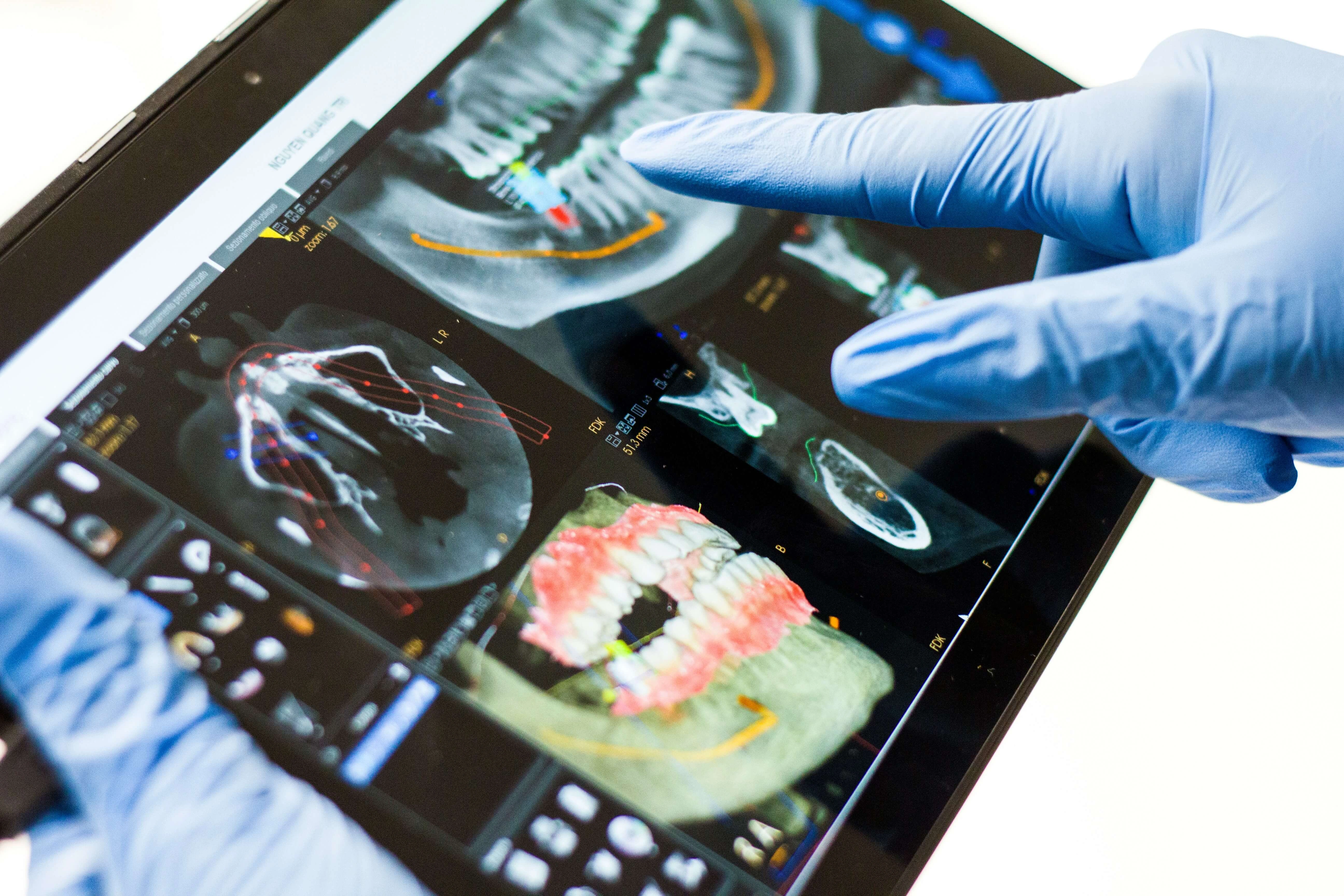 discussing the possibility of Dental Implants Lexington KY