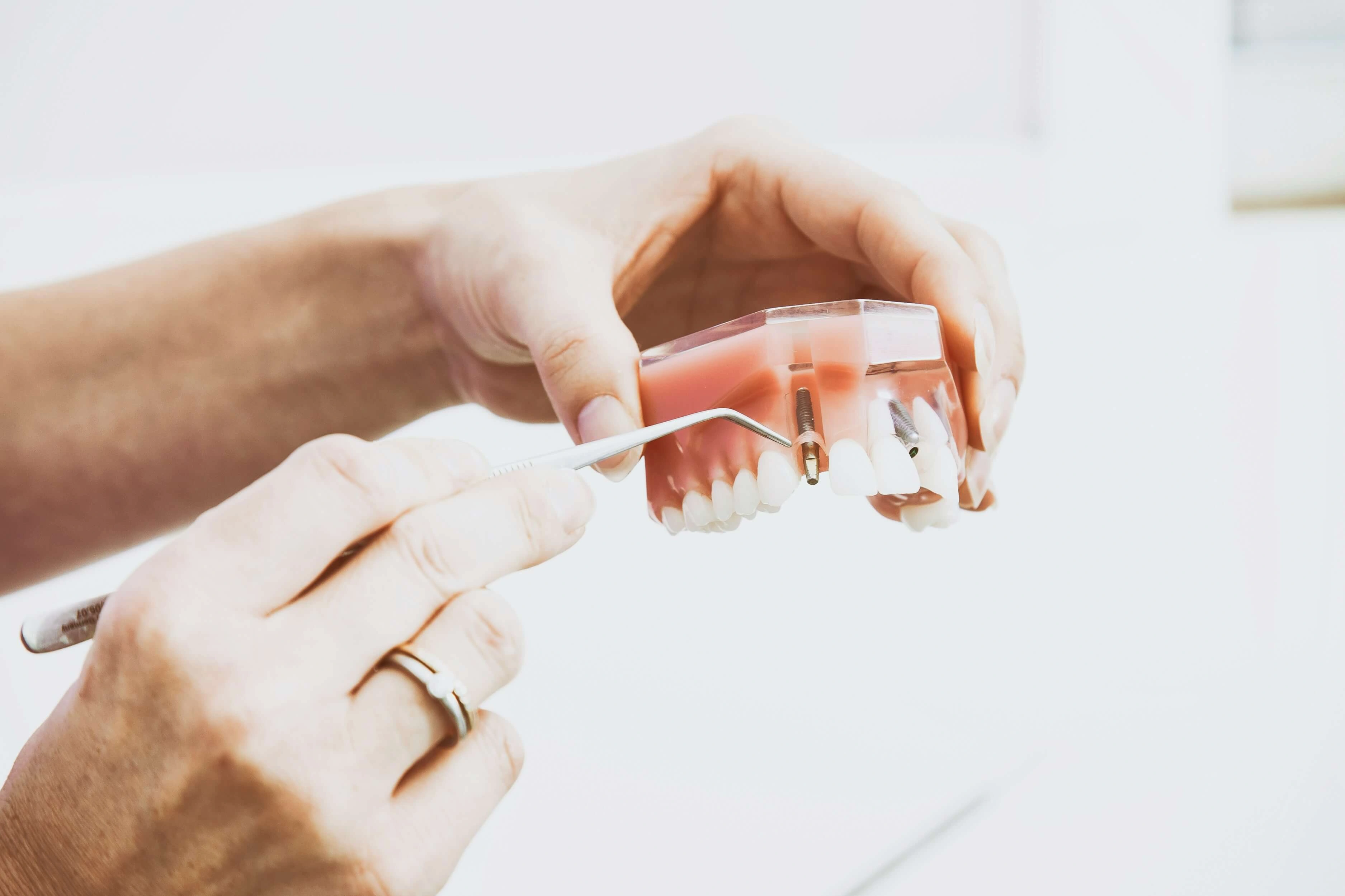 discussing Dental Implants Lexington KY