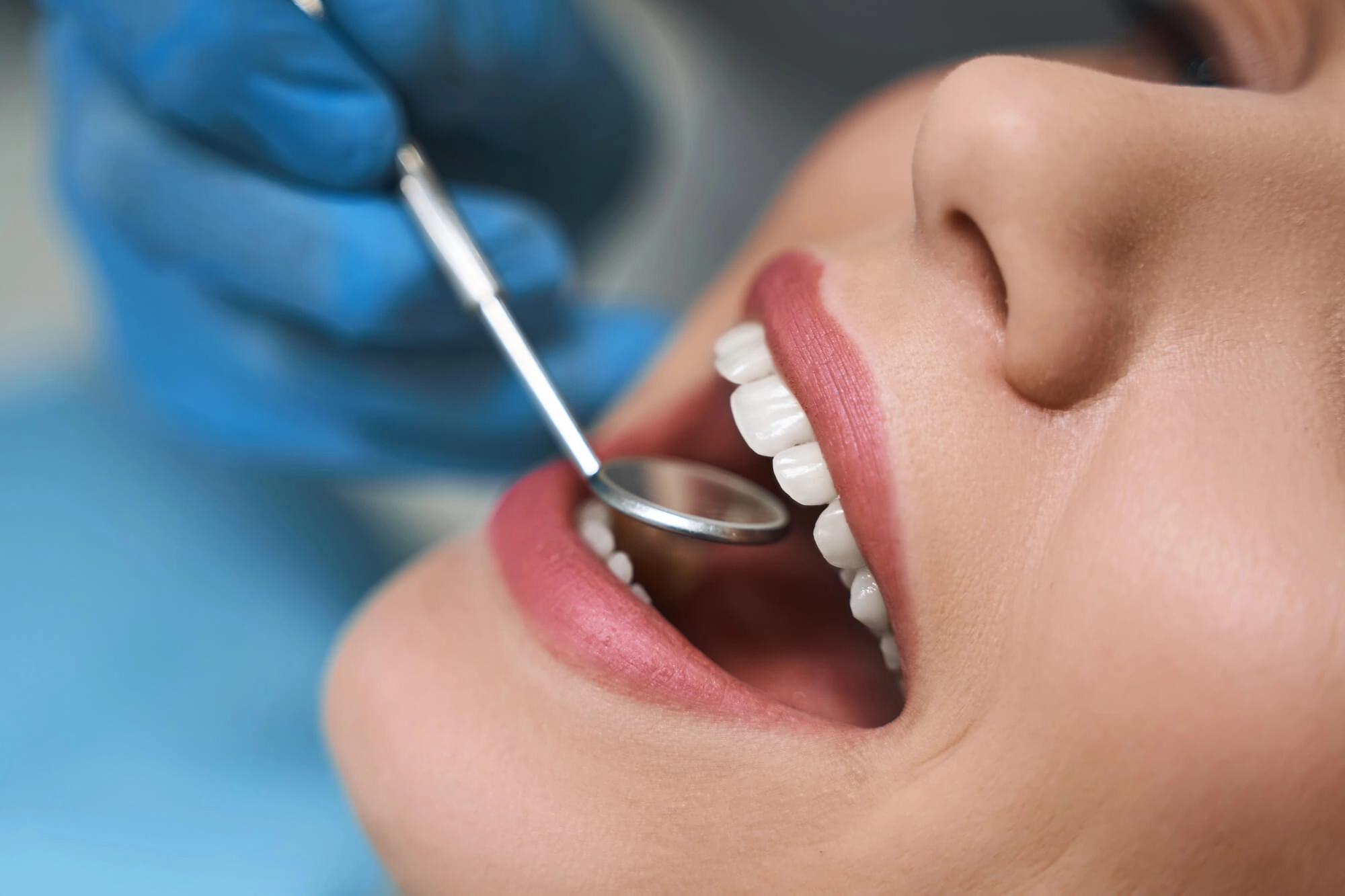 checking All on X Dental Implants