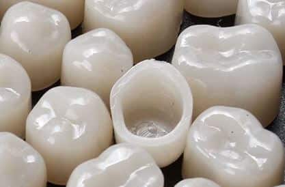 dental crown last