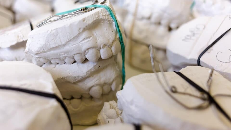 dental crown