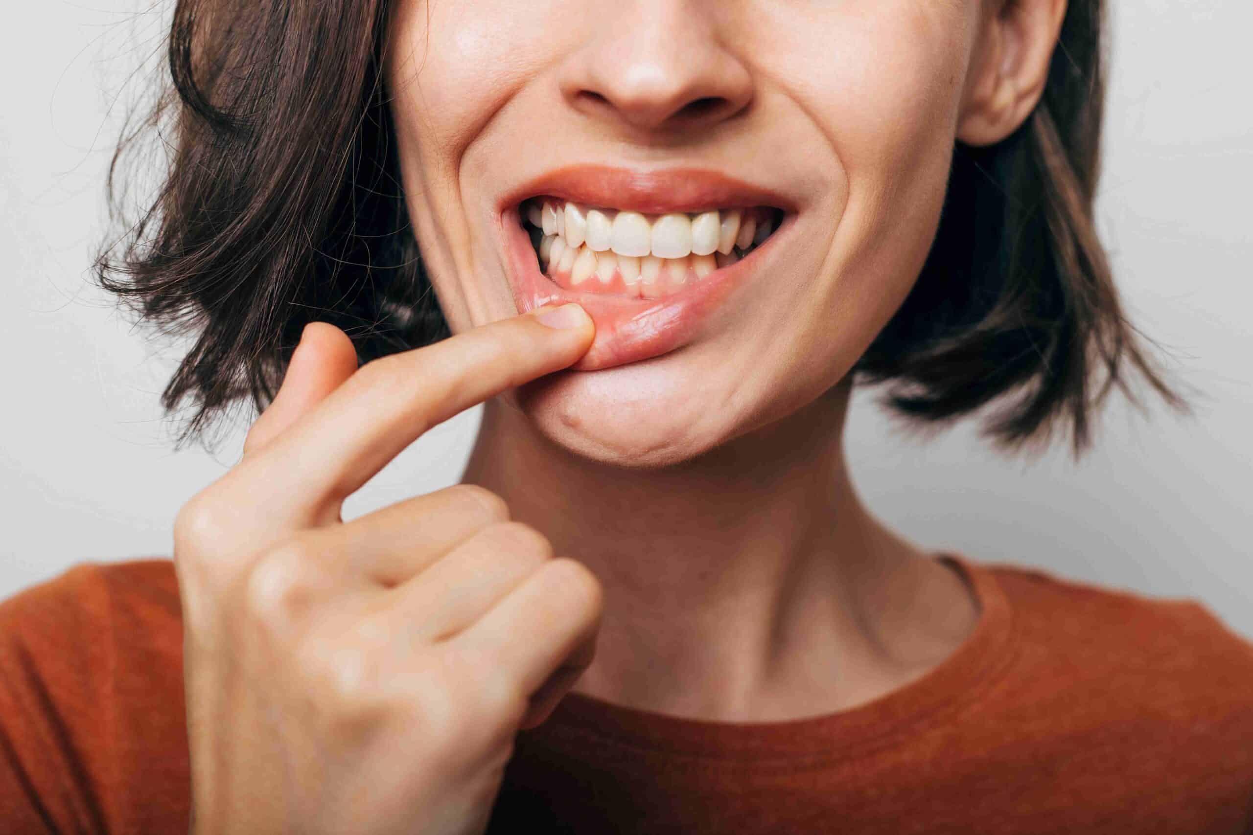 Why Do My Gums Bleed When I Brush My Teeth?