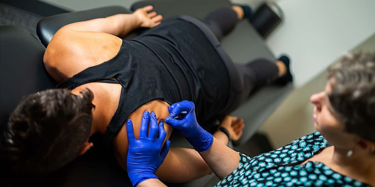 Adding Dry Needling to Your Chiropractic Practice 