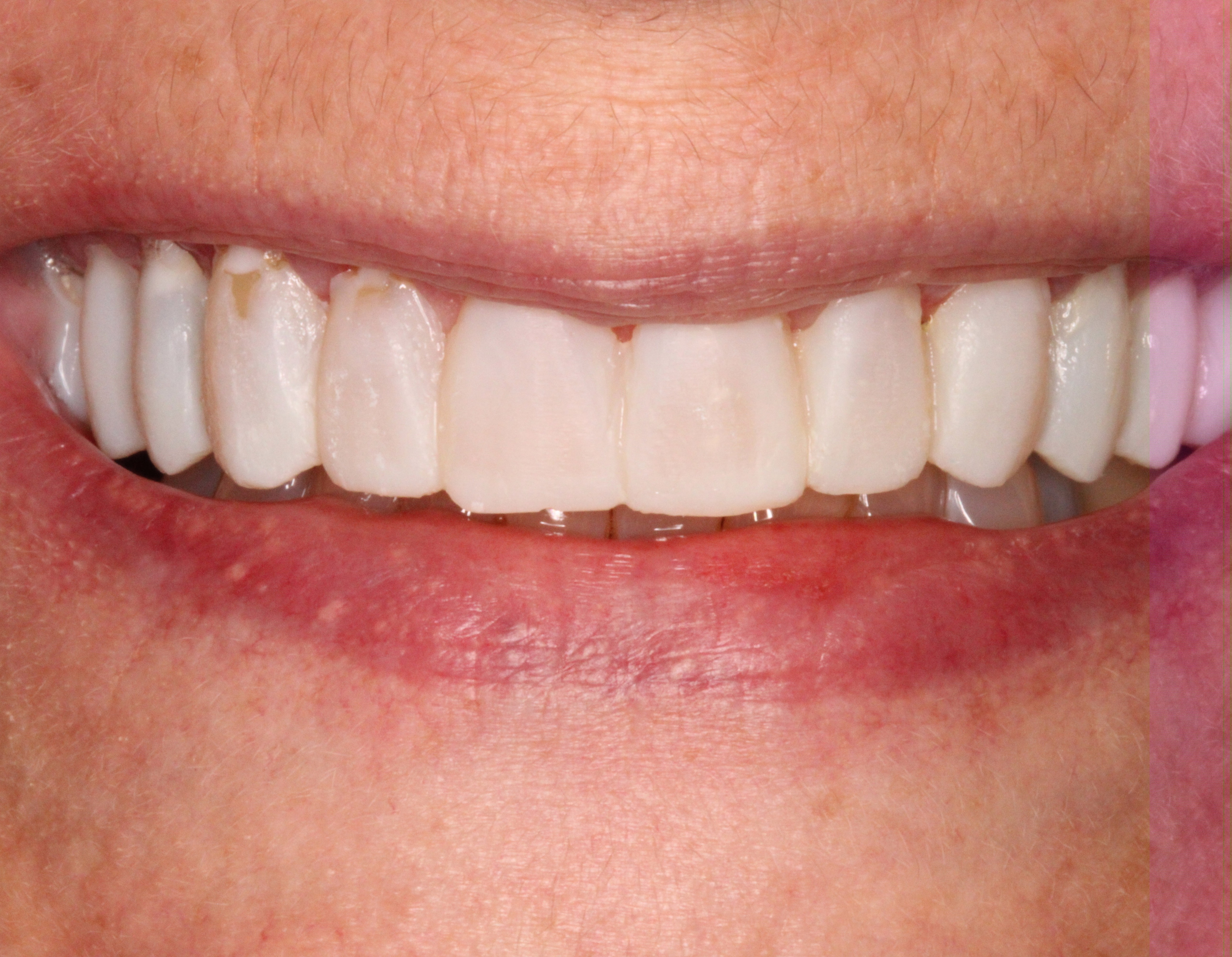 Before Image