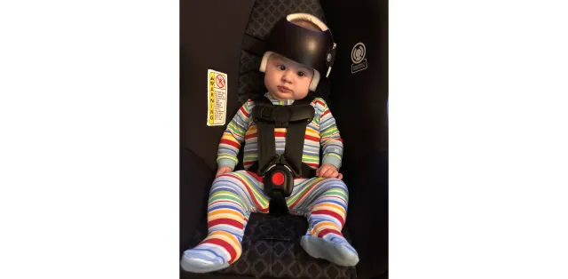 Infant Medical Helmets