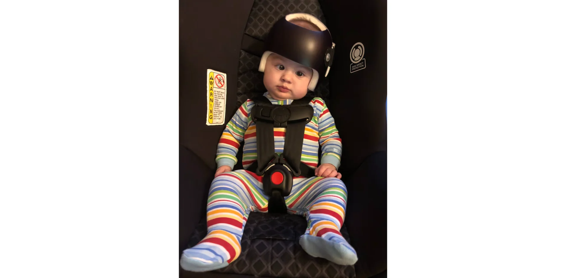 Infant Medical Helmets