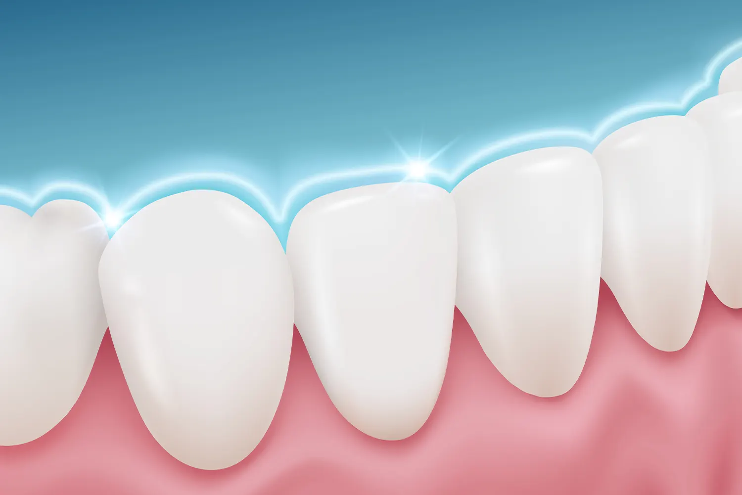 Fluoride Treatments in Zephyrhills, FL | Beachwood Dental