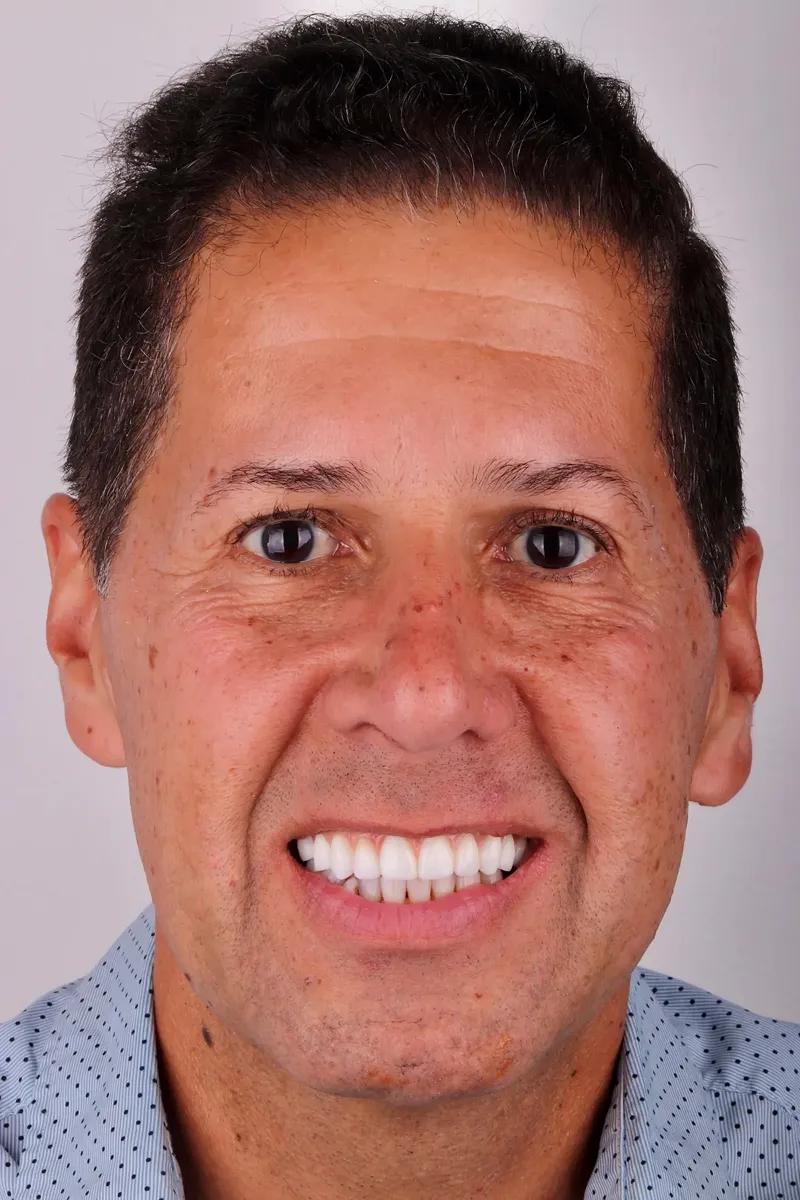 David, a real patient of Sapphire Smiles