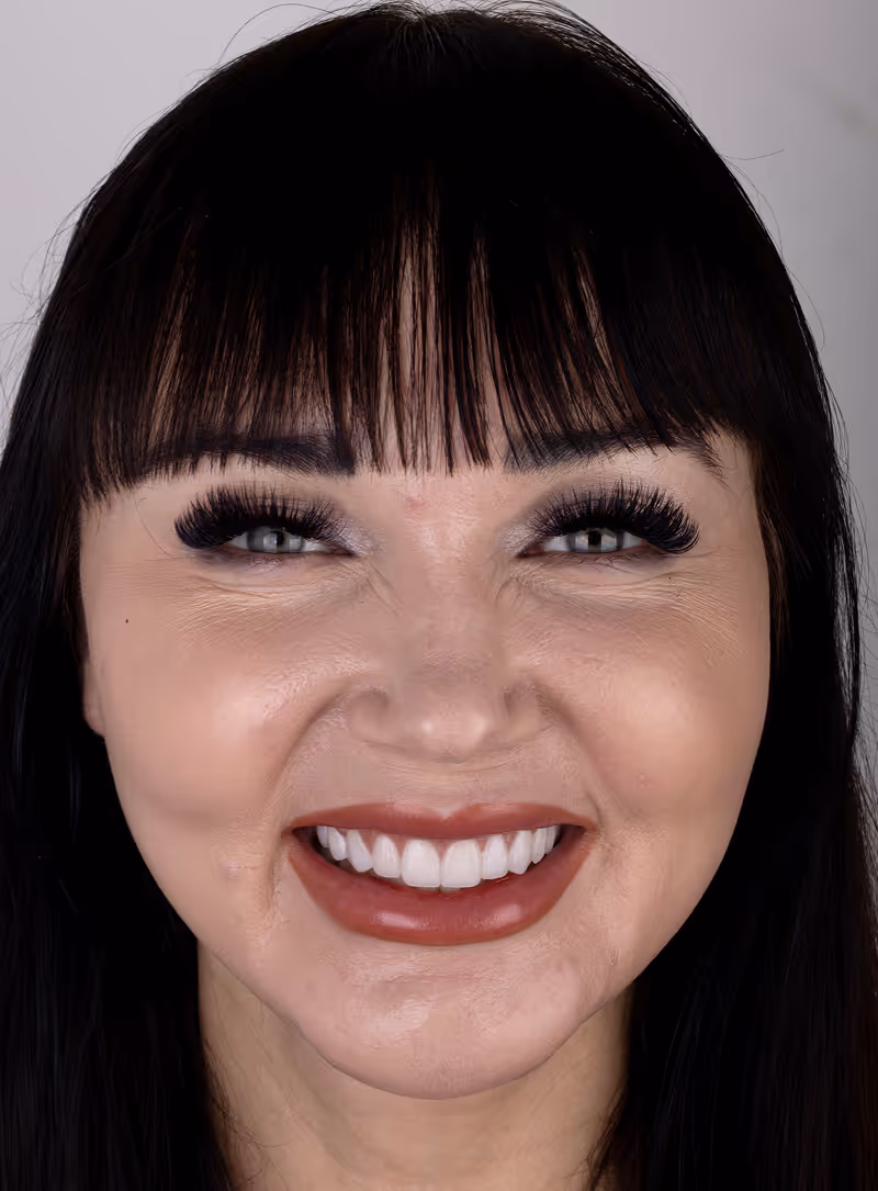 Actual patient of Sapphire Smiles