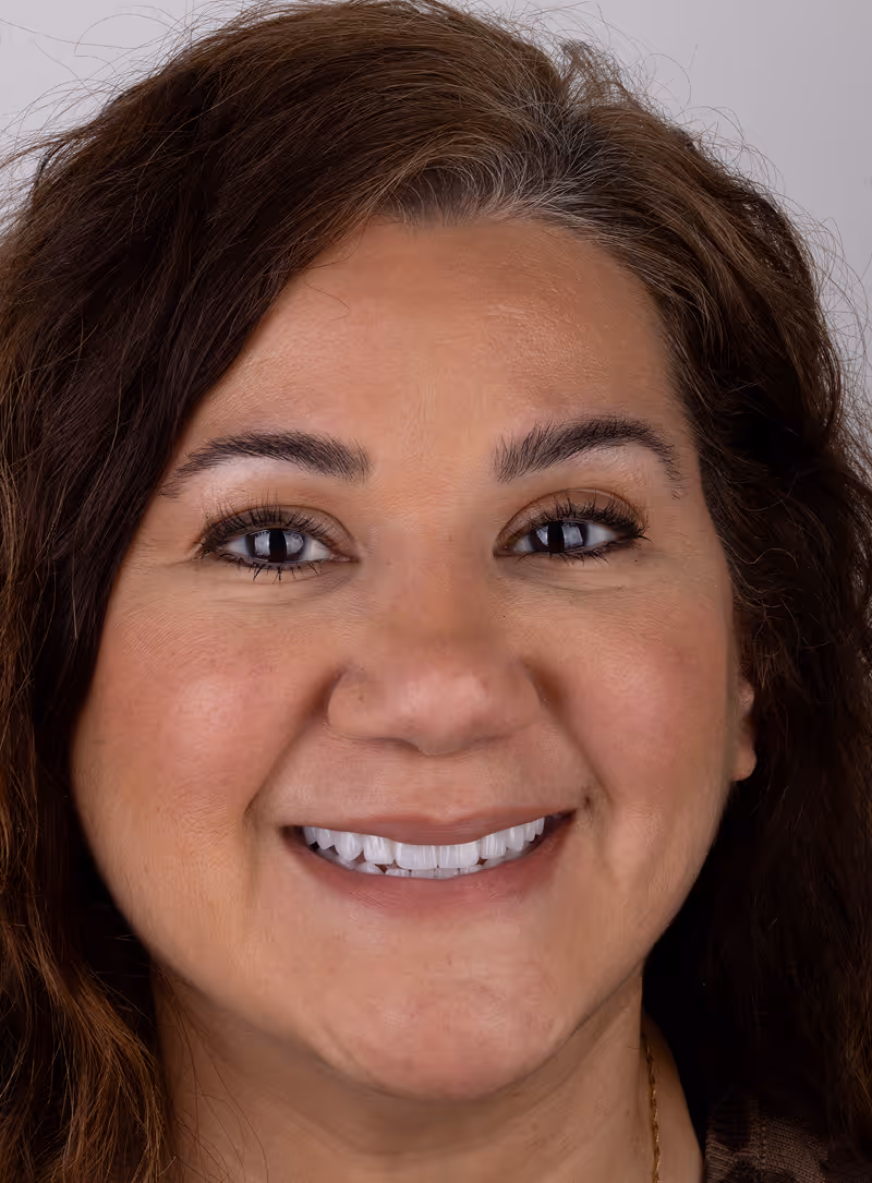 Patient after dental implants at Sapphire Smiles