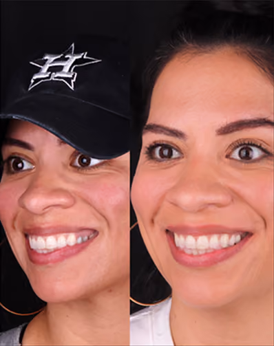 Surgical placement of the implant at Sapphire Smiles