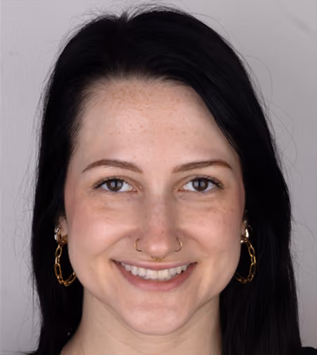 Smile straighter with Invisalign from Sapphire Smiles
