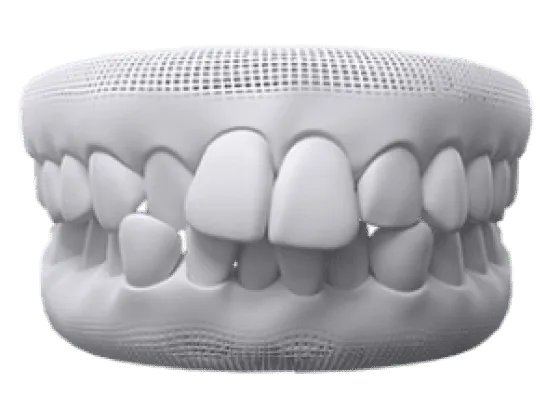orthodontics image