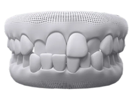 orthodontics image