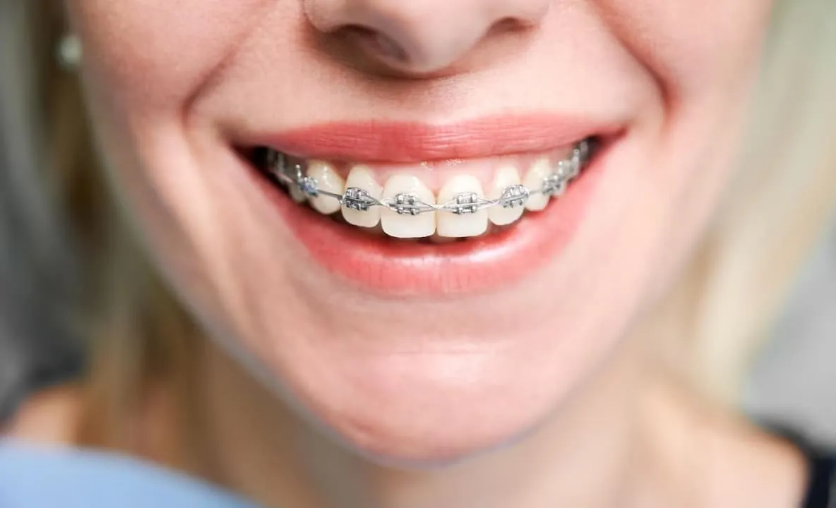 orthodontics image