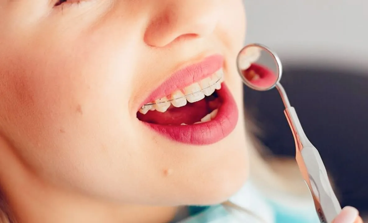 orthodontics image