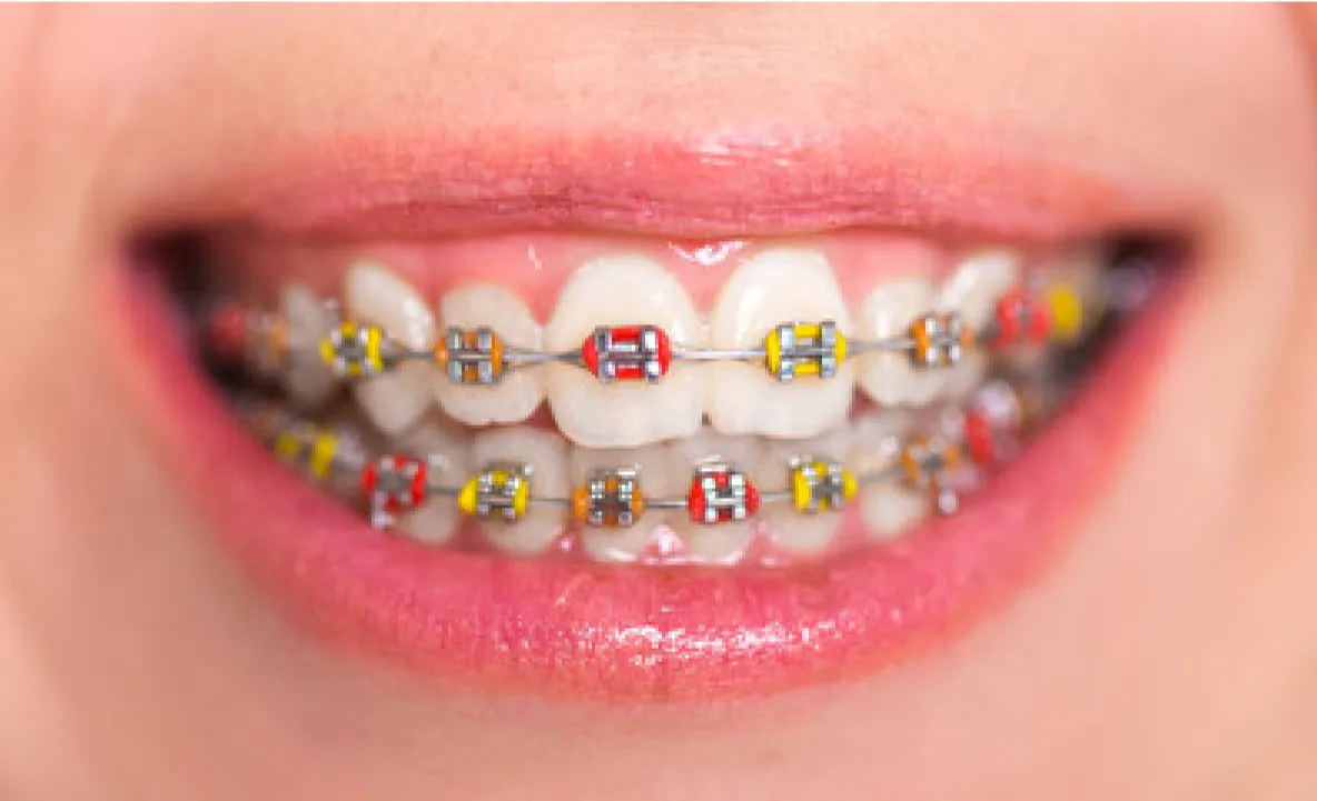dental