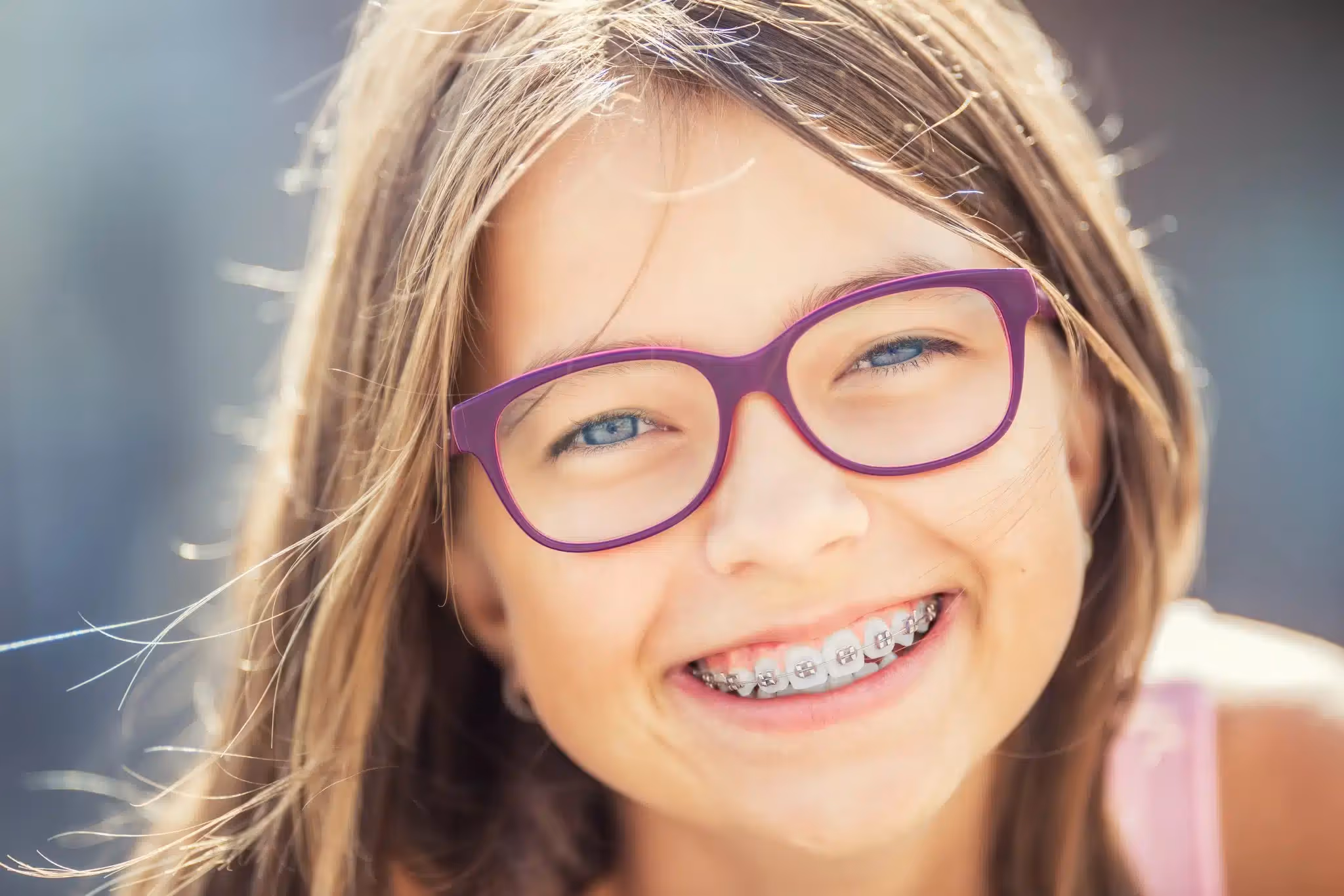 Should I Wear a Retainer?