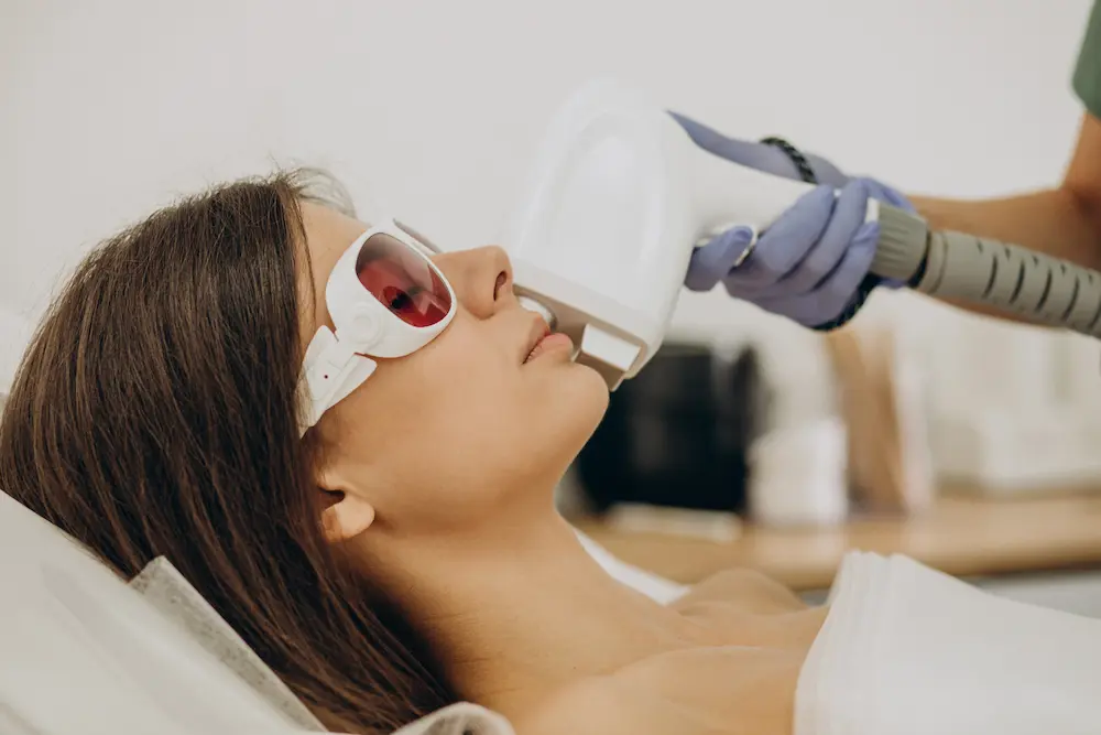 Laser hair removal