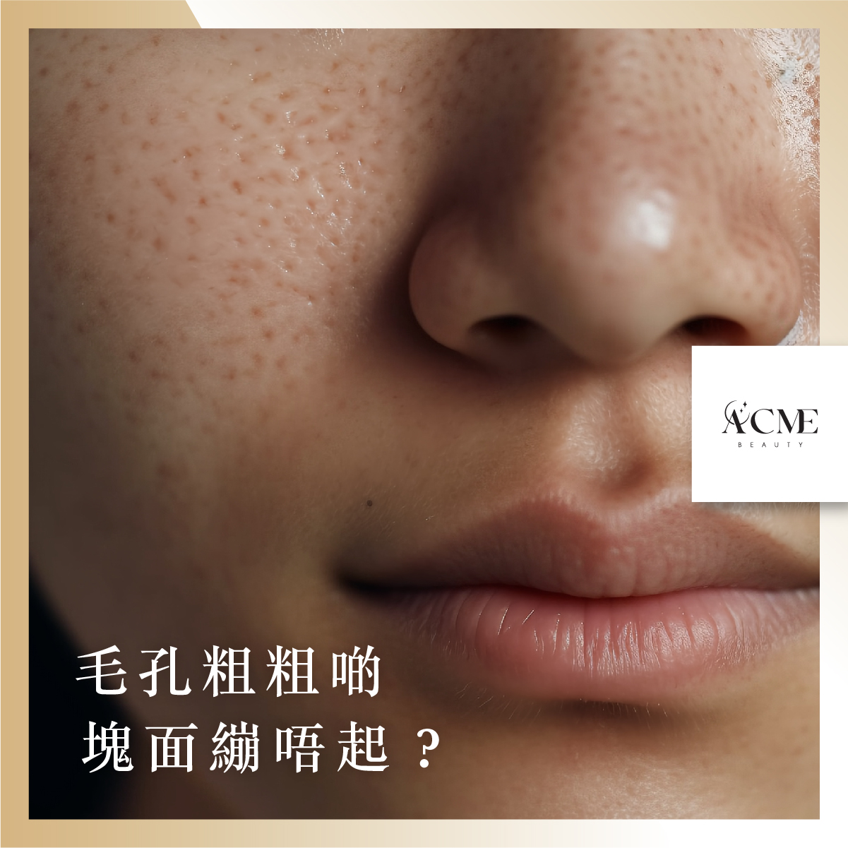 揾返青春唔一定要捱刀！