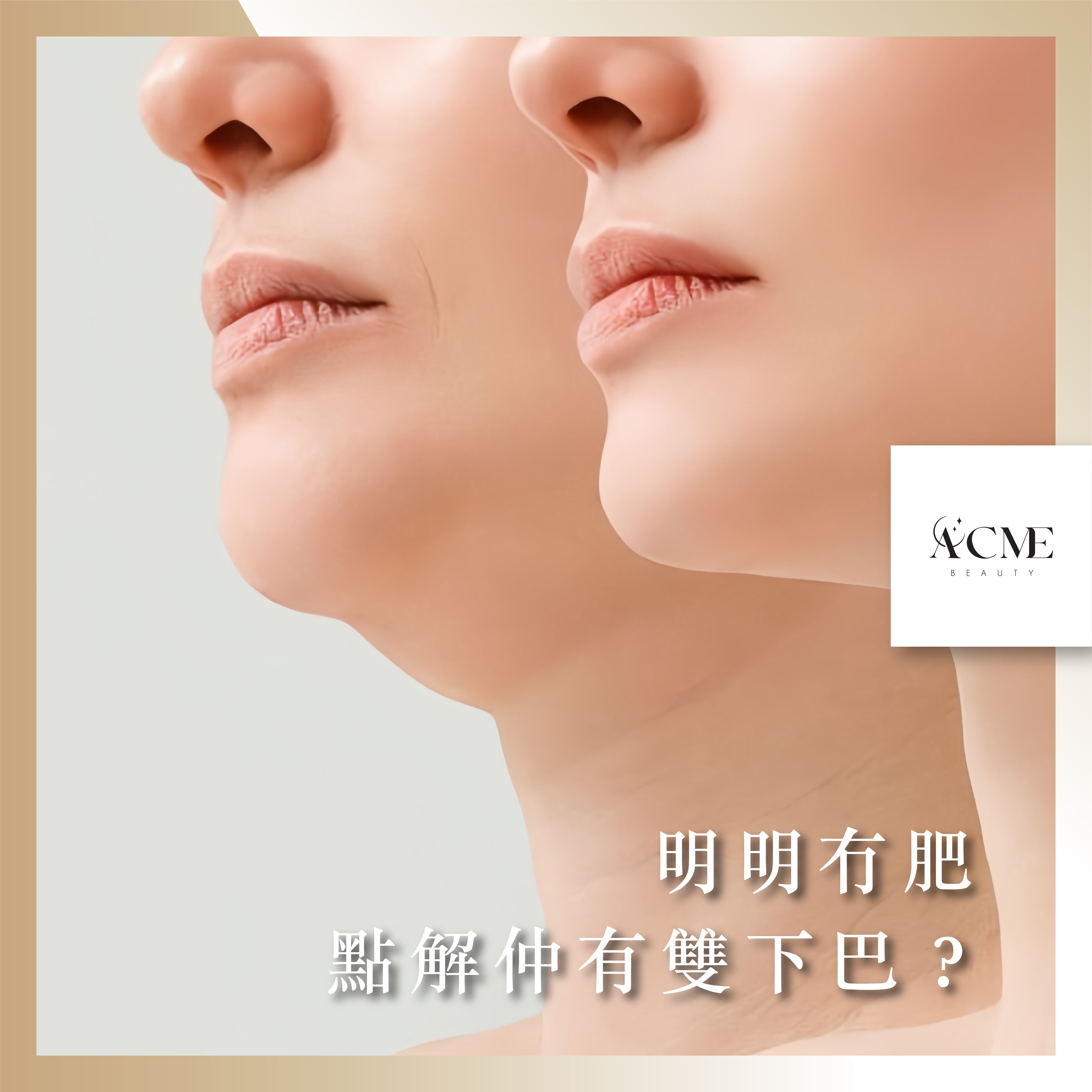 AcmeBeauty-想輕鬆獲得小蠻腰？