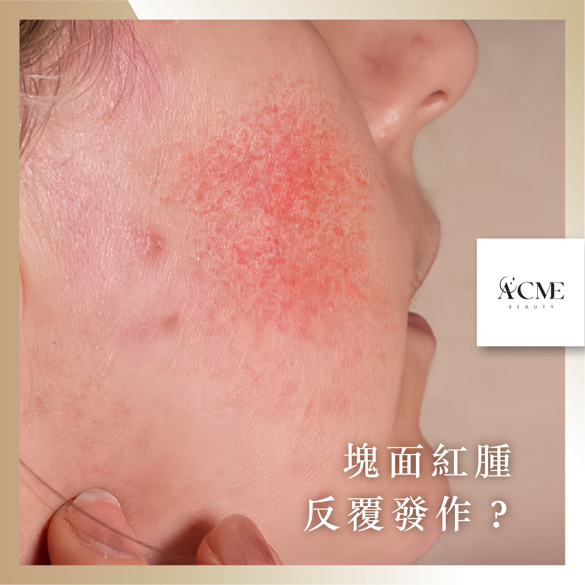 AcmeBeauty-想輕鬆獲得小蠻腰？