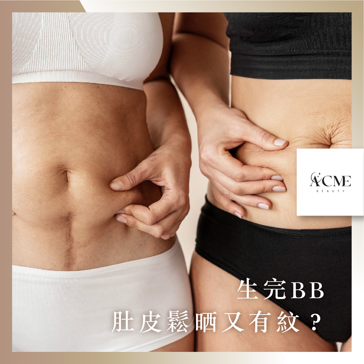 AcmeBeauty-想輕鬆獲得小蠻腰？