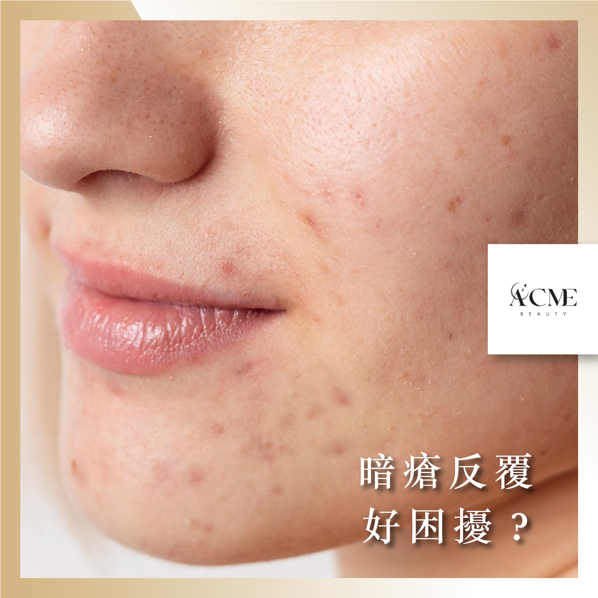 AcmeBeauty-想輕鬆獲得小蠻腰？