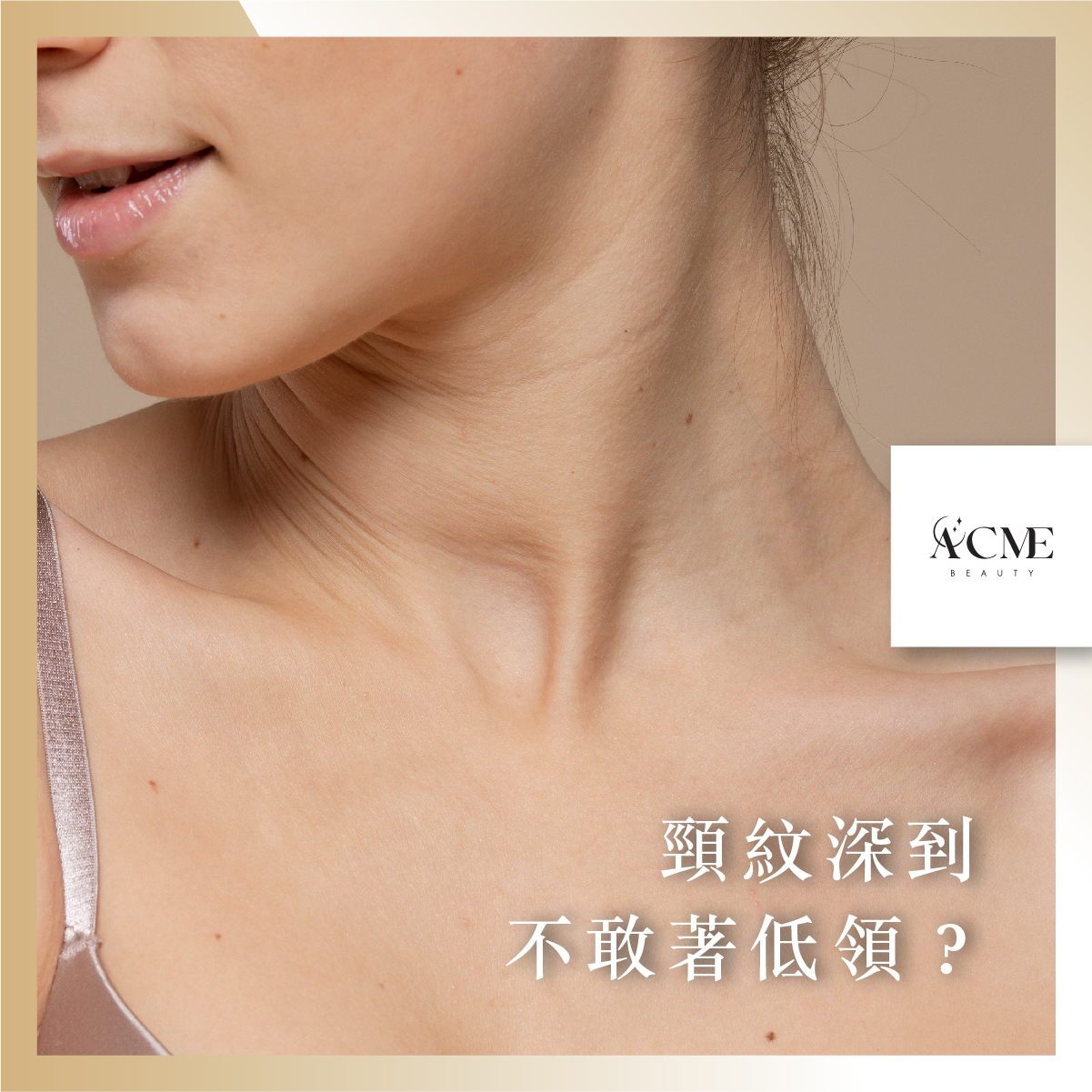 AcmeBeauty-想輕鬆獲得小蠻腰？